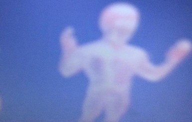 Ребенок с синдромом Дауна сфотографировал своего ангела-хранителя