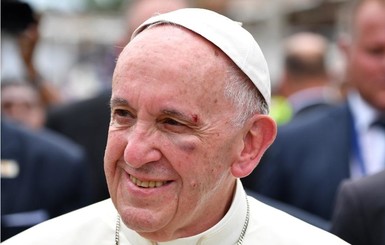 Папа Римский рассек бровь во время поездки в Колумбию