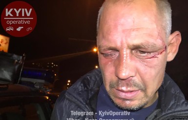 Нападение в Киеве на девушку: очевидцы сделали вид, что ничего не видели