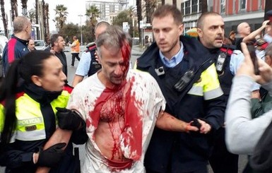 В Каталонии появились первые пострадавшие в столкновениях с полицией