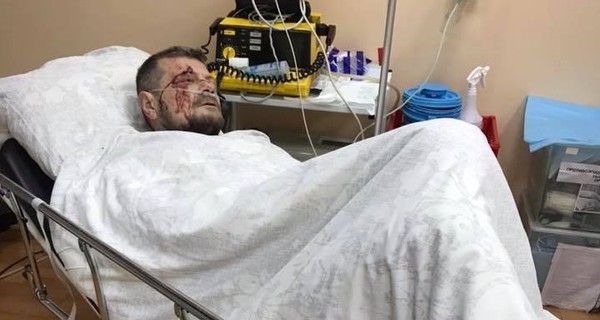 Депутат Мосийчук ранен в результате взрыва в Киеве, два человека погибли