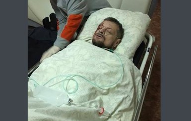 Мосийчук в реанимации: состояние тяжелое, готовится еще одна операция