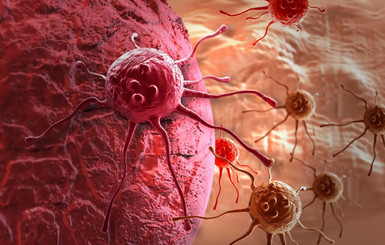 Американские ученые тестируют универсальный анализ крови на наличие восьми видов рака