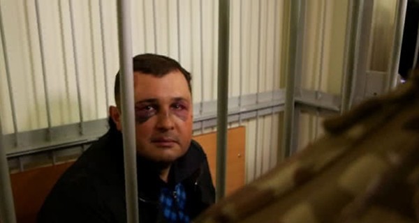СБУ - о гематомах под глазами экс-депутата Шепелева: 