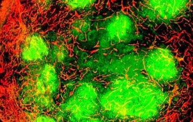 Ученые создали вирус, убивающий рак