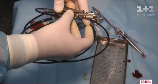 На Волыни хирурги оперируют больных раком с помощью гидроскальпеля