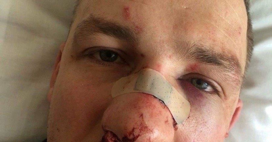 Избиение Левченко расследуют как насилие в отношении госдеятеля