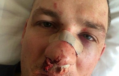 Избиение Левченко расследуют как насилие в отношении госдеятеля