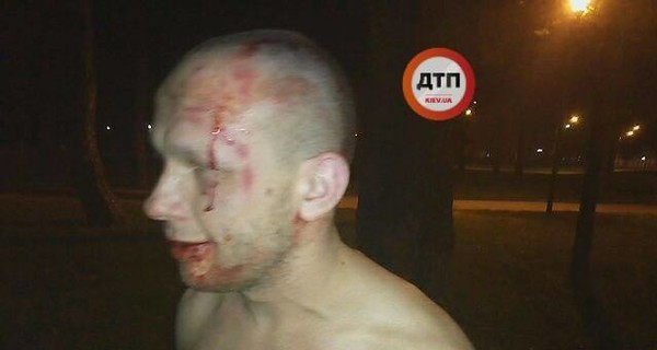 Массовая драка в Киеве: один из участников бросил людям под ноги гранату