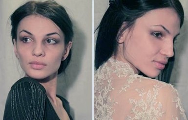 В Москве после пластики носа умерла 29-летняя девушка