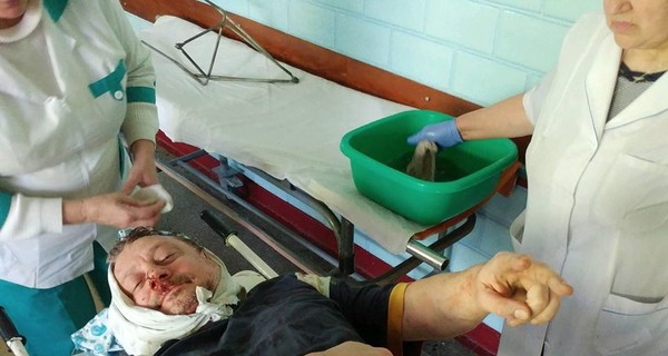 В Кременчуге неизвестные избили Олега Филипаса - соратника Саакашвили  