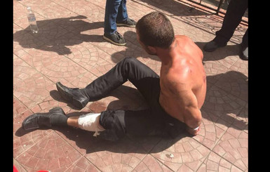 В Киеве копы смогли остановить хулигана с ножом только после выстрела ему в ногу 