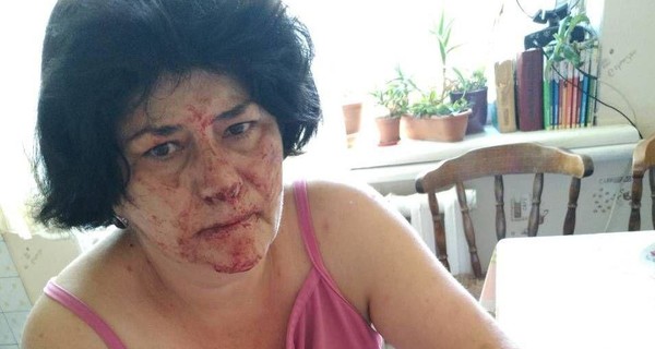 Под Киевом женщину избили за замечание о бросании бутылки мимо мусорного бака