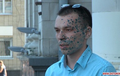 Блогера, которого обвиняют в госизмене, в Житомире облили зеленкой 