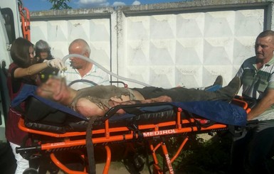 В Минске слесарь загорелся, когда закурил, ремонтируя машину 