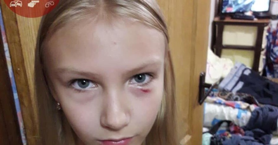 В Киеве пожилая женщина напала на 11-летнюю девочку и ее отца