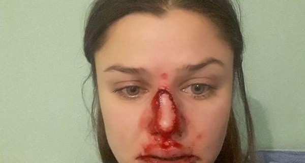 В Киеве психолог заявила о домашнем насилии: в ситуацию вмешался  Юрий Луценко  