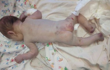 Избитый и брошенный: в Первомайске врачи борются за жизнь новорожденного 