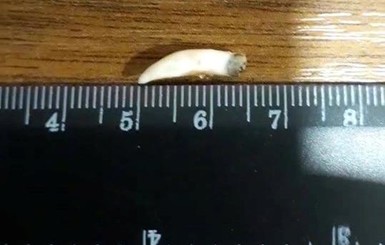 Жительница Хуста нашла в купленном зельце зуб