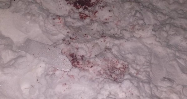 Новогодние происшествия украинцев: упасть с елки и ампутировать фейерверком руку