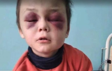 Мачеха избитого мальчика: Ваня ударился, когда полез за котиком и упал с печи