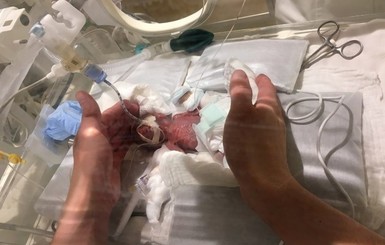 Из больницы в Токио выписали мальчика, родившегося с весом 268 граммов