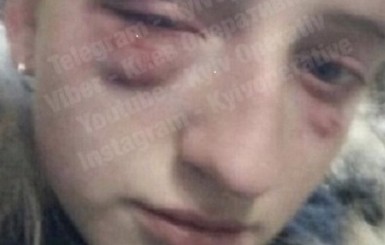 В Киеве избили школьницу