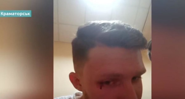 ГБР расследует избиение мужчины в Краматорске полицейскими