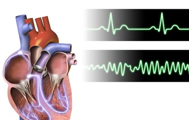 Кардиологи рассказали, как укрепить сердце после 40 лет