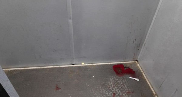 Дочь домашнего тирана, изрезавшего сбежавшую жену: Я хочу, чтобы он сел