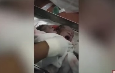 Сиамских близнецов в детскую больницу перевезут на реанимобиле 