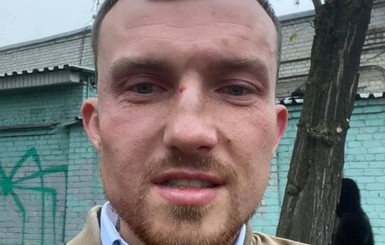 В Киеве был избит член аттестационной комиссии ГПУ
