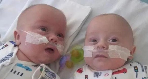 В Великобритании спасли самых маленьких в мире близнецов