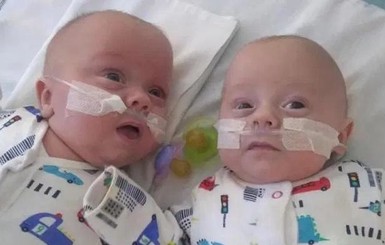 В Великобритании спасли самых маленьких в мире близнецов