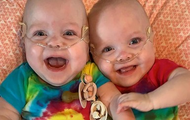 Cамые недоношенные близнецы в мире отпраздновали первый день рождения