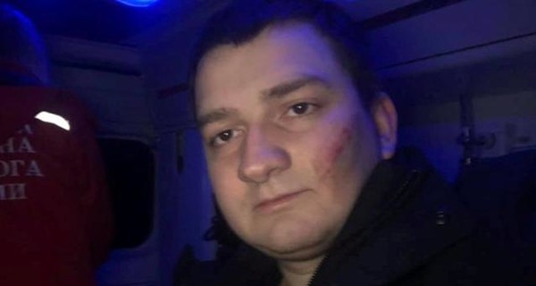 Избиение депутата Ананченко оказалось инсценировкой