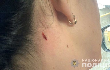 Прогуливаясь, почувствовала жжение в шее: в Николаеве женщина была ранена рядом с полицейским стрельбищем 