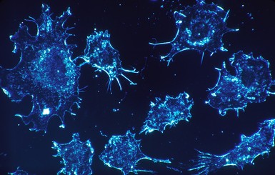 Американские учёные: Ультразвук способен обезвреживать раковые клетки, не влияя на здоровые