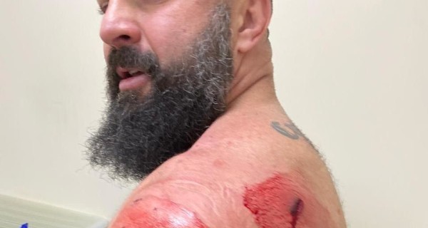 Власти Мукачево после очередной перестрелки попросили Зеленского победить криминал 