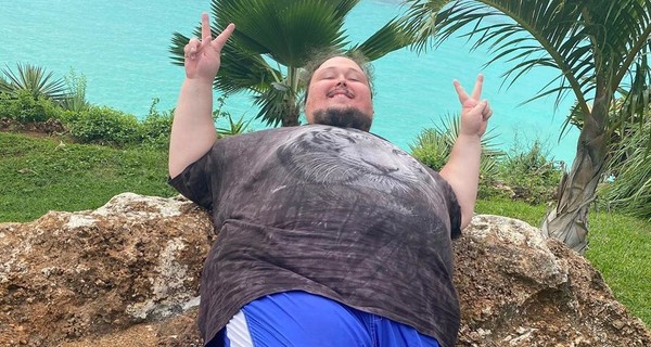 У 242-килограммового сына Никаса Сафронова беда с лицом