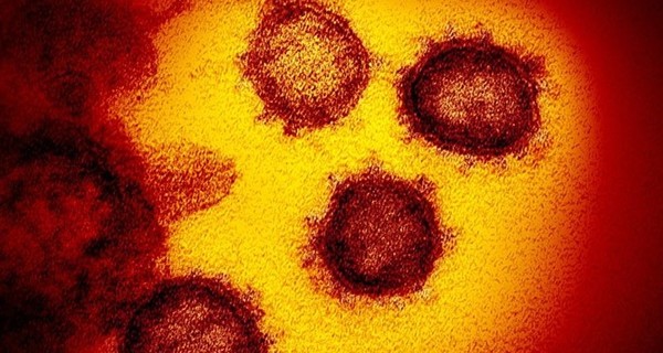 В Италии от коронавируса умер третий человек