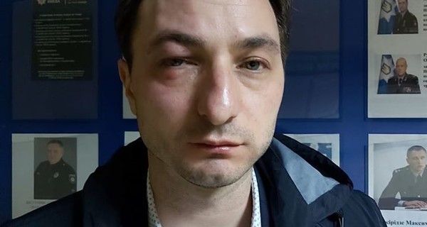 В Киеве избили главврача Национального института рака