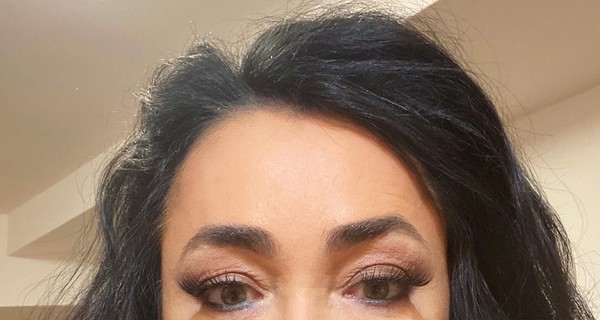 Лолита призналась, что во время карантина сделала себе пластику