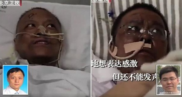 У двух китайских врачей, заразившихся коронавирусом в Ухане, потемнела кожа 