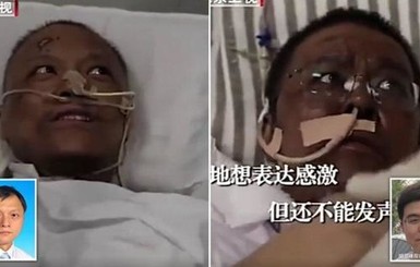 У двух китайских врачей, заразившихся коронавирусом в Ухане, потемнела кожа 