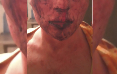 Представился девушкой: полиция рассказала свою версию избиения парня под Житомиром