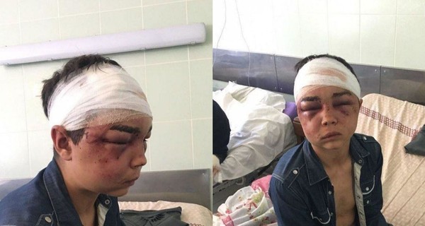 Под Харьковом из-за девушки жестоко избили и изнасиловали 17-летнего парня: полиция открыла дело