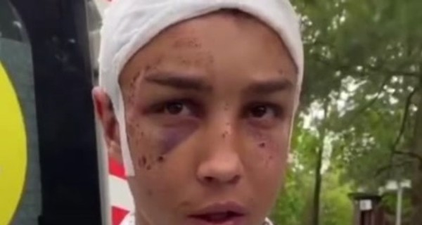 В Уфе за избиение подростка оштрафовали 17-летнего парня