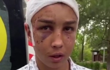 Мужчин, которые жестоко избили и изнасиловали 17-летнего парня под Харьковом, взяли под стражу