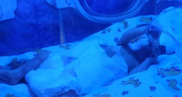 В Запорожье 16-летняя девушка родила малыша весом 690 грамм